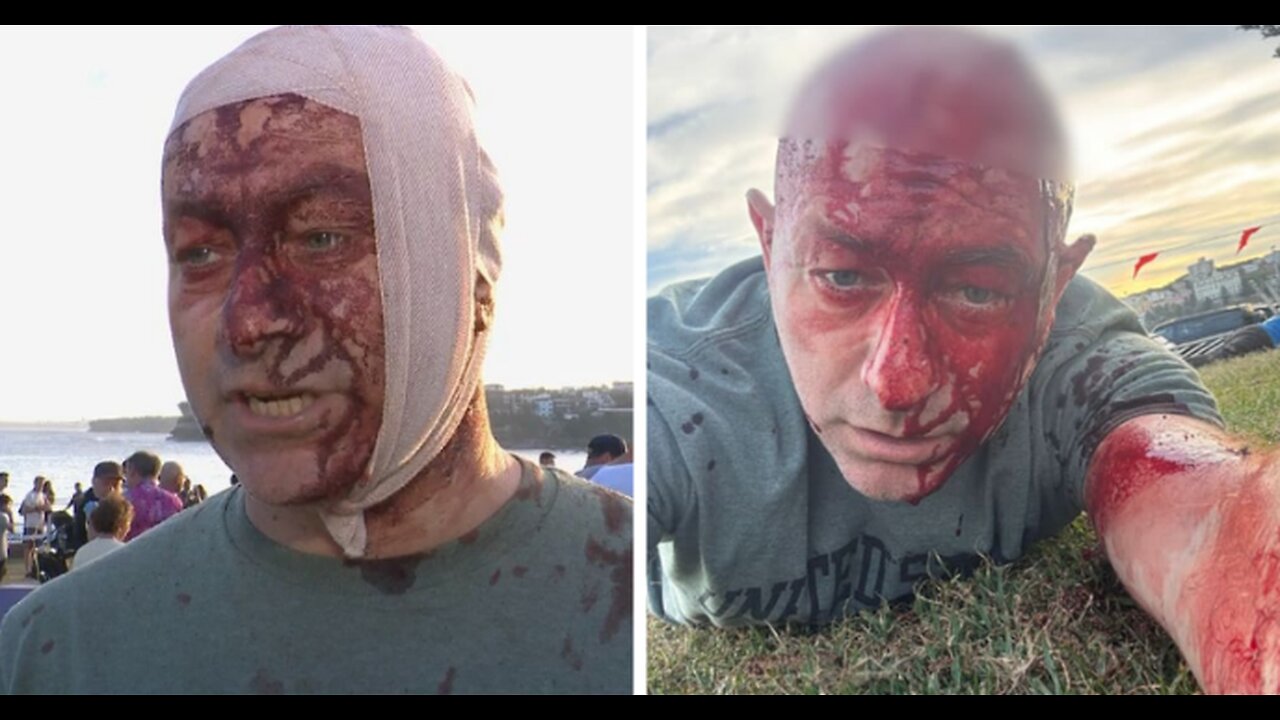 The Propagandist at Bondi Beach