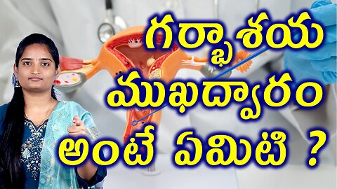 గర్భాశయ ముఖద్వారం అంటే ఏమిటి? What Is Cervix Infection | Cervicitis Homeopathy Treatment Medicine