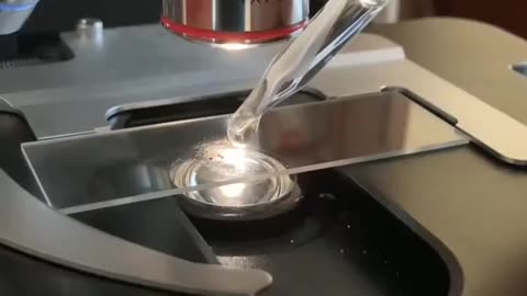 Why CHARCOAL is Used to Treat POISONing☠️ ⁉️