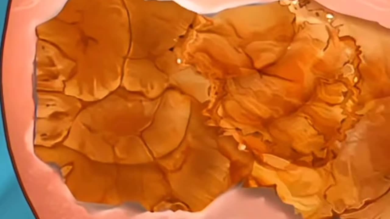 Here’s How Doctors Remove Stubborn Warts — Safely and Painlessly!