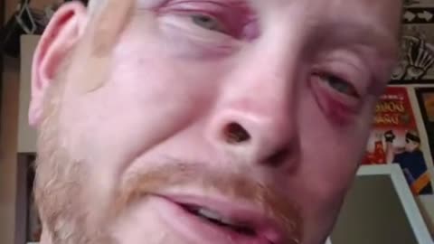 why people don't help people