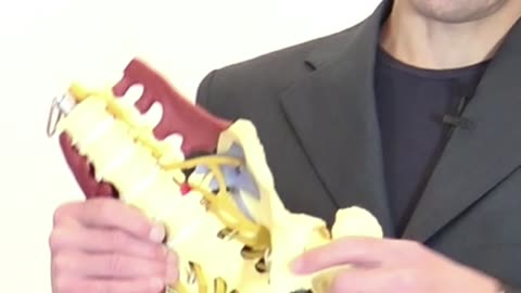 Dolore all'Anca, la Postura Piegata Avanti della Schiena può Essere Causata dall'Artrosi all'Anca