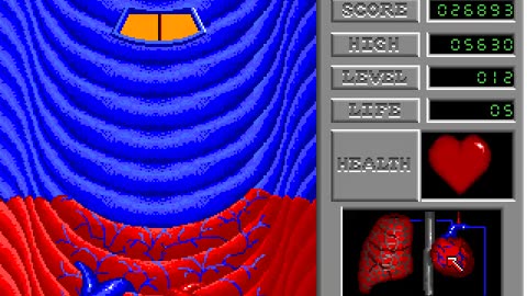 Amiga 500 Longplay - Anatomic Man - FR