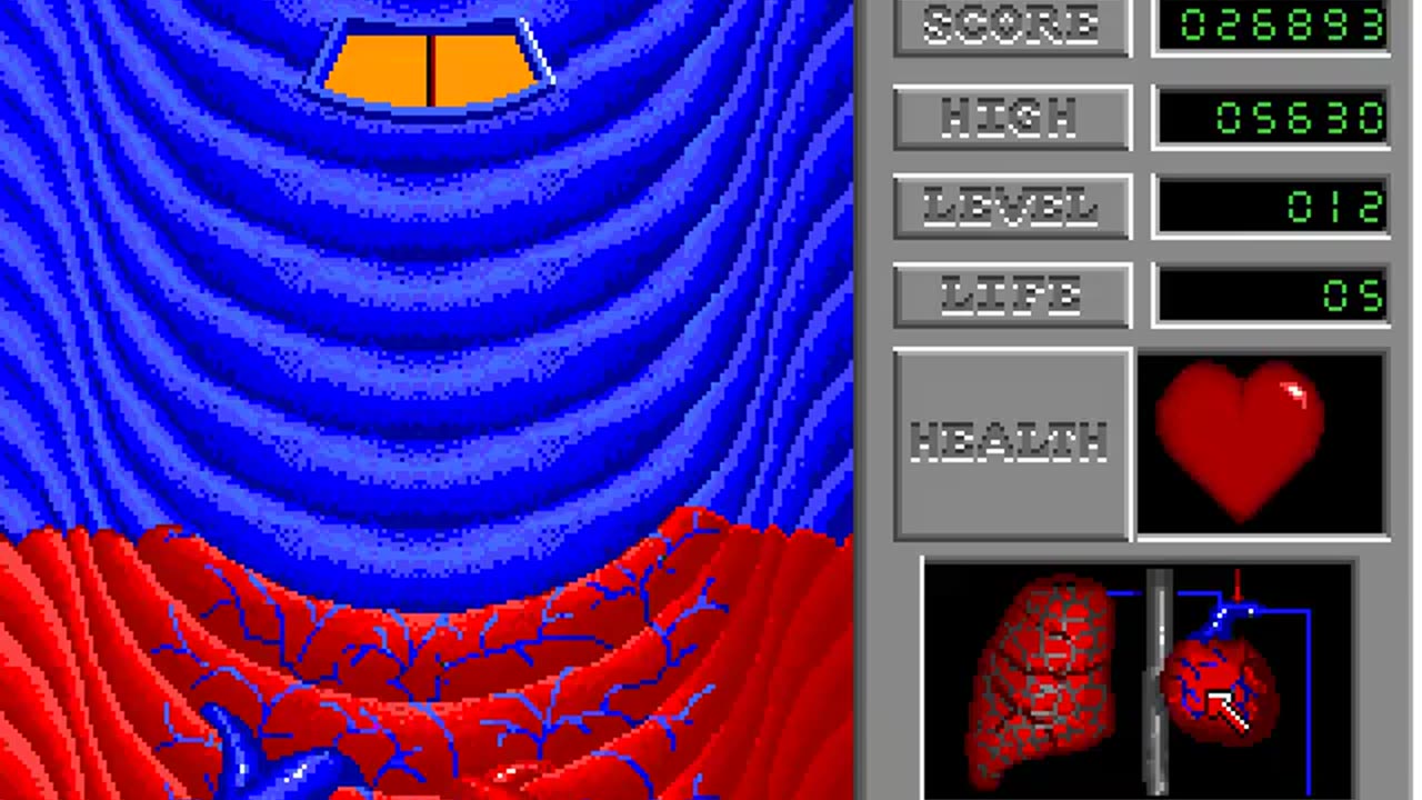 Amiga 500 Longplay - Anatomic Man - FR