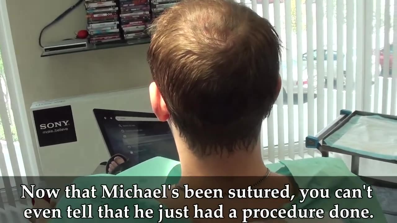 Undetectable Suture Line in Just 10 Days | Dr. Brett Bolton