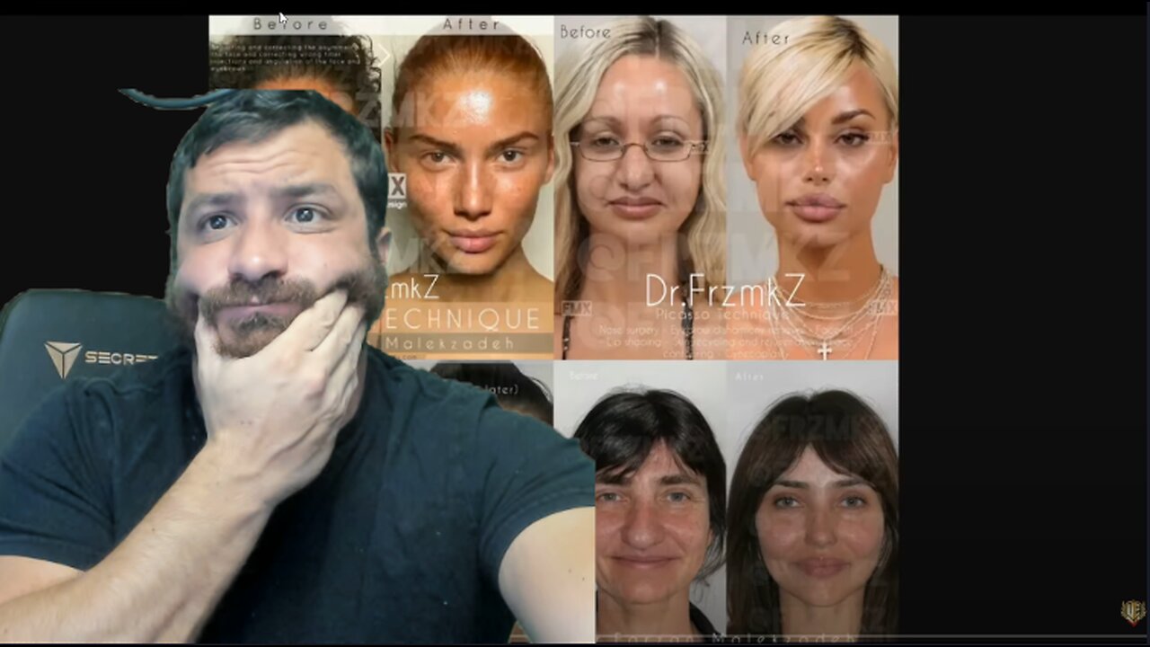 Sulk Stream #348 Face Lift