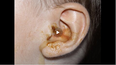 Are childhood illnesses "normal"- NO!