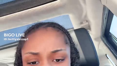 GIRL GOES LIVE SHOWING BALD SPOT KONG ALLEGEDLY DID !!!
