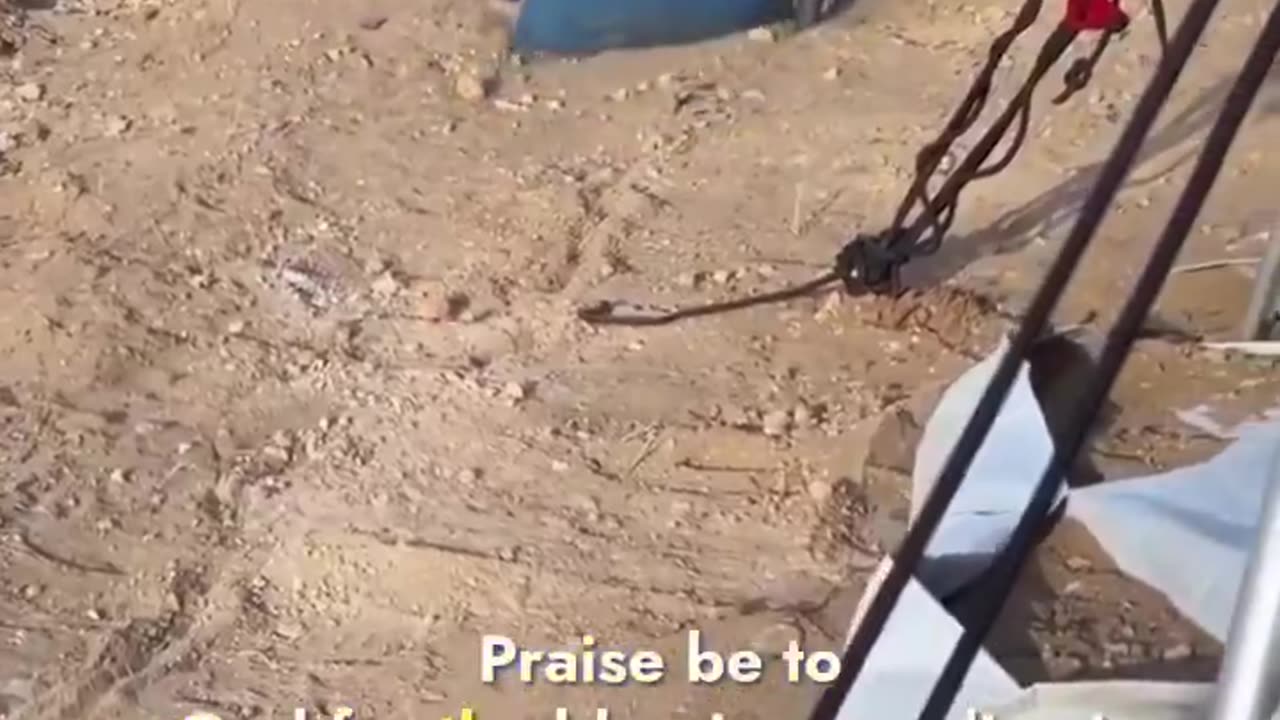 A Palestinian Boy In Gaza With Both Legs Amputated After Being Bombed By The Israelis Plays