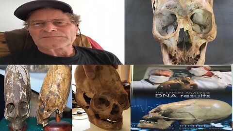 DNA Results Of Elongated Skulls From Peru