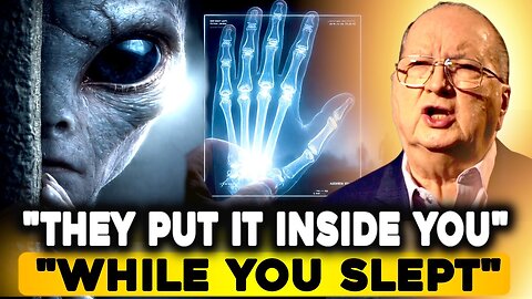 Alien Implants Found in Human Bodies Shock Medical Experts | Jordan Maxwell