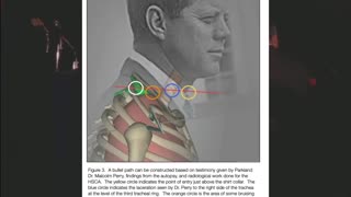 Texas Crime Travelers- Man in South Knoll Car Lines Up Perfectly With Doc'd Bullet Marks on TSBD