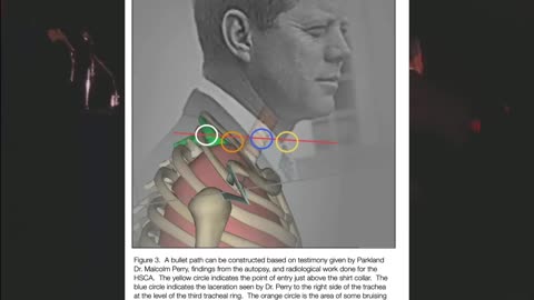 Texas Crime Travelers- Man in South Knoll Car Lines Up Perfectly With Doc'd Bullet Marks on TSBD