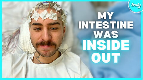 My Intestine Turned Inside Out | BORN DIFFERENT