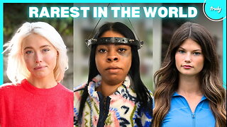 6 Inspiring People Living With The Rarest Conditions | BORN DIFFERENT