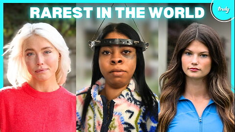 6 Inspiring People Living With The Rarest Conditions | BORN DIFFERENT