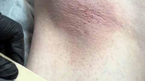 Underarm Waxing with Sexy Smooth Golden Allure Hard Wax | @waxxologystudio