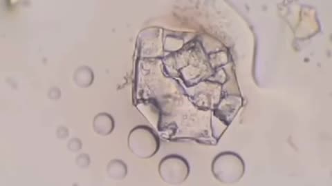 NANO TECHNOLOGY IN DENTAL ANESTHETIC