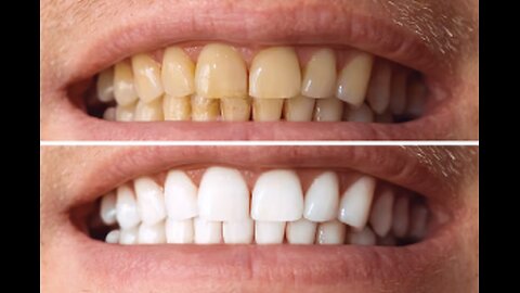 Ancient Himalayan Dental Ritual Rebuilds Teeth 3X Faster