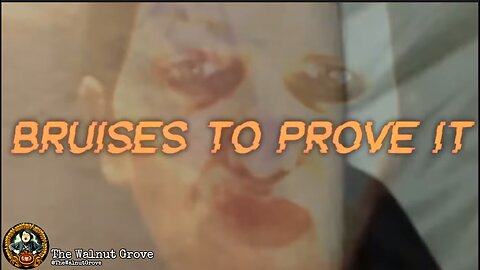 Bruises to Prove It - The Walnut Grove