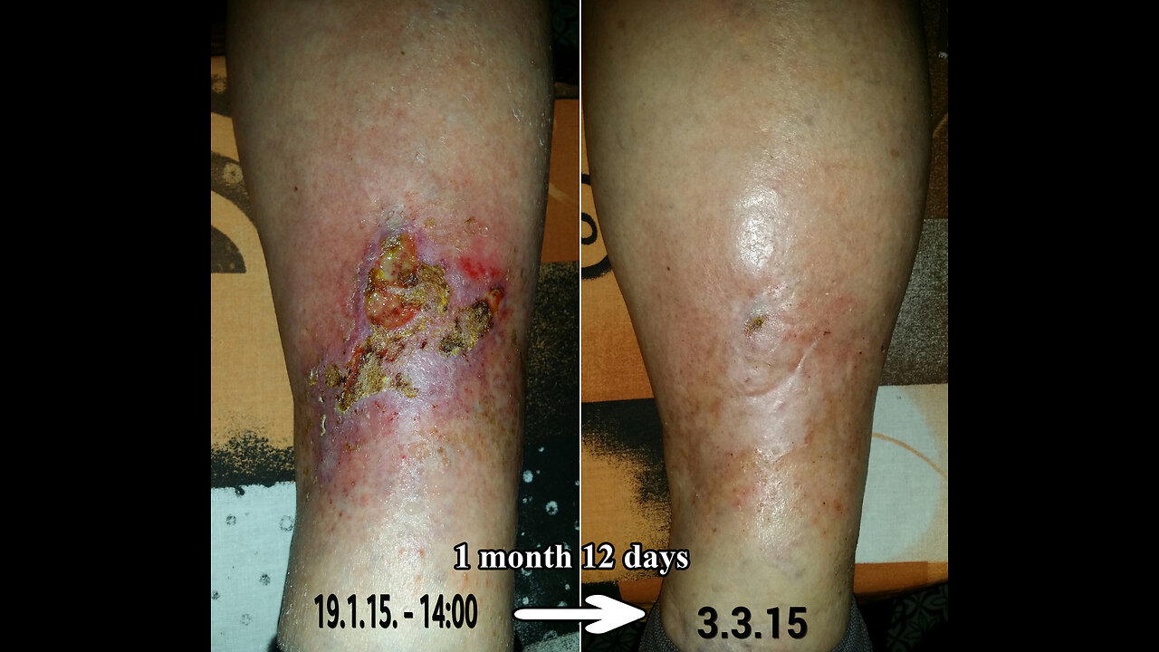 THE POWER OF COLLOIDAL SILVER