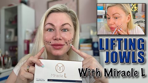 Lifting Jowls with Miracle L (Liquid PCL), AceCosm.com and Code Jessica10 Saves you money