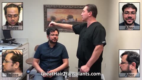MaxHarvest™ Plus Transformation: Dhruv’s Hair Restoration by Dr. Brett Bolton