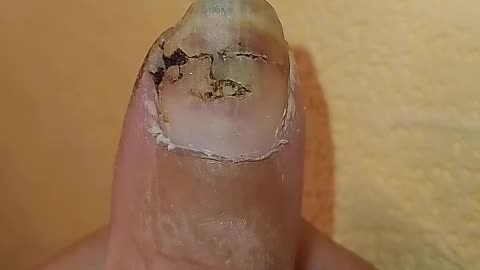 Cumaru is nasty!