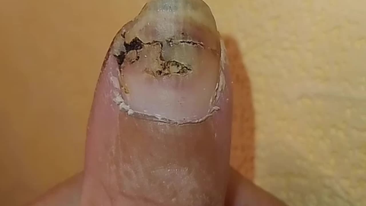 Cumaru is nasty!