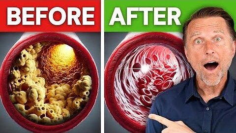 #1 BEST Meal to Prevent a Heart Attack and Stroke pt. fuller