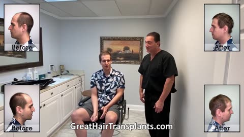 Tim’s MaxHarvest™ Plus Hair Transplant by Dr. Brett Bolton