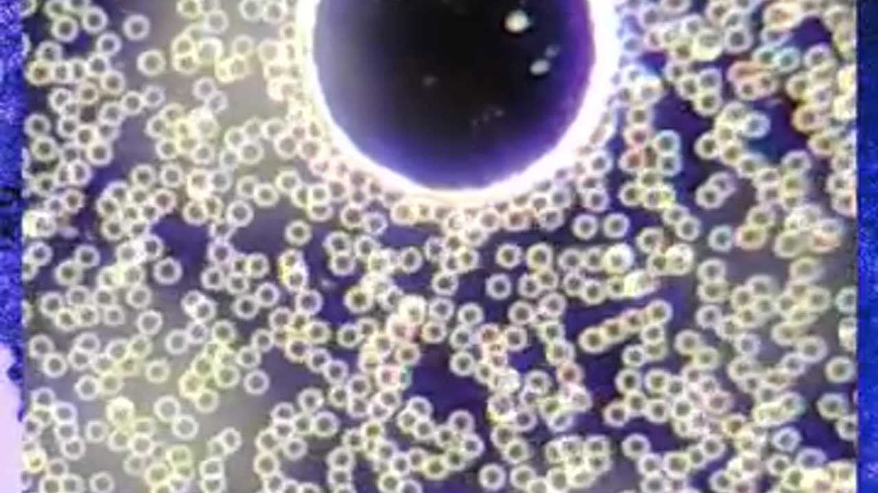 LOS VACUNADOS TIENEN LA SANGRE ENVENADA