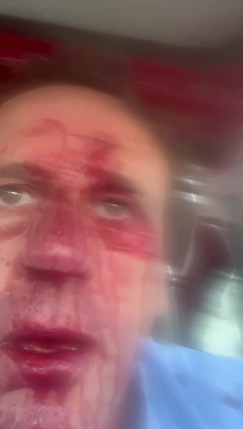 Dhuna ndaj Ardian Çipës, reagimi pas ngjarjes së rëndë