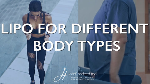 Liposuction for Different Body Types