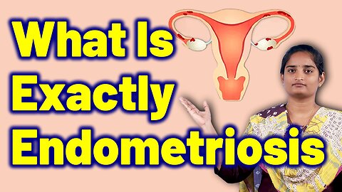 What is Endometriosis in Women Pelvic inflammatory condition | Treatment Cure Medicine | Gynaecology