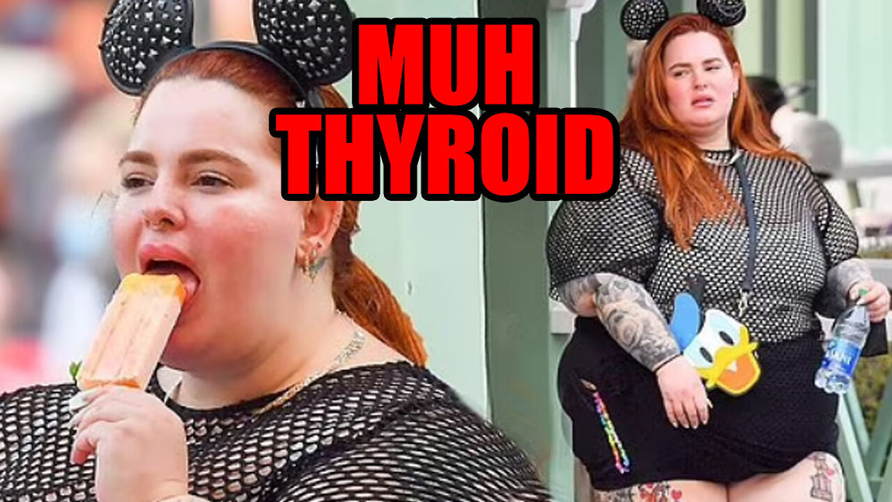 Debunking The Excuse Of Hypothyroidism For Morbid Obesity