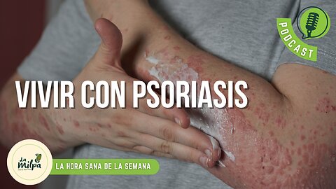 Vivir con Psoriasis.