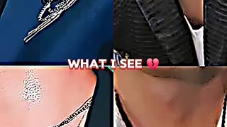 Incredible: It's really heart breaking 💔 😢 ||#bts #jungkook #taehyung #suga #jim