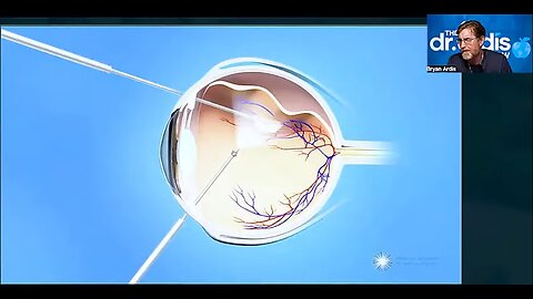 The Dr Ardis Show_Cataracts_What Your Doctor Won’t Tell You Part 1
