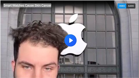 Smart Watches Cause Skin Cancer