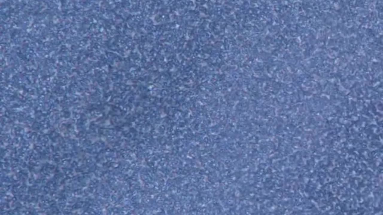 Sugar Vs Bacteria Under Microscope
