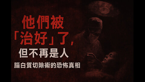 腦白質切除術：醫學史上最殘酷的錯誤實驗｜Lobotomy: The Darkest Medical Tragedy of the Modern Age