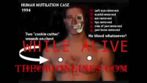 Aliens have been soul/adrenochrome harvesting Human Beings alpha attack patter 1