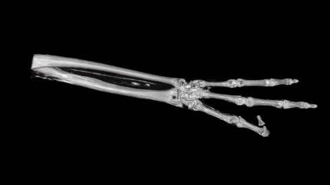 🤯👽 Montserrat's Alien Implant Revealed in Stunning DICOM Footage! | TheTruthAbove