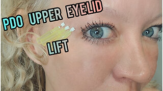 PDO Facial Threads for Orbital Ridge Upper Eyelid Edited Version😍