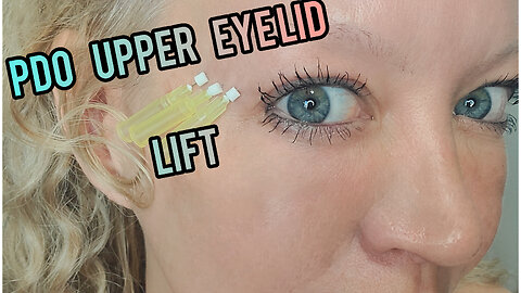 PDO Facial Threads for Orbital Ridge Upper Eyelid Edited Version😍