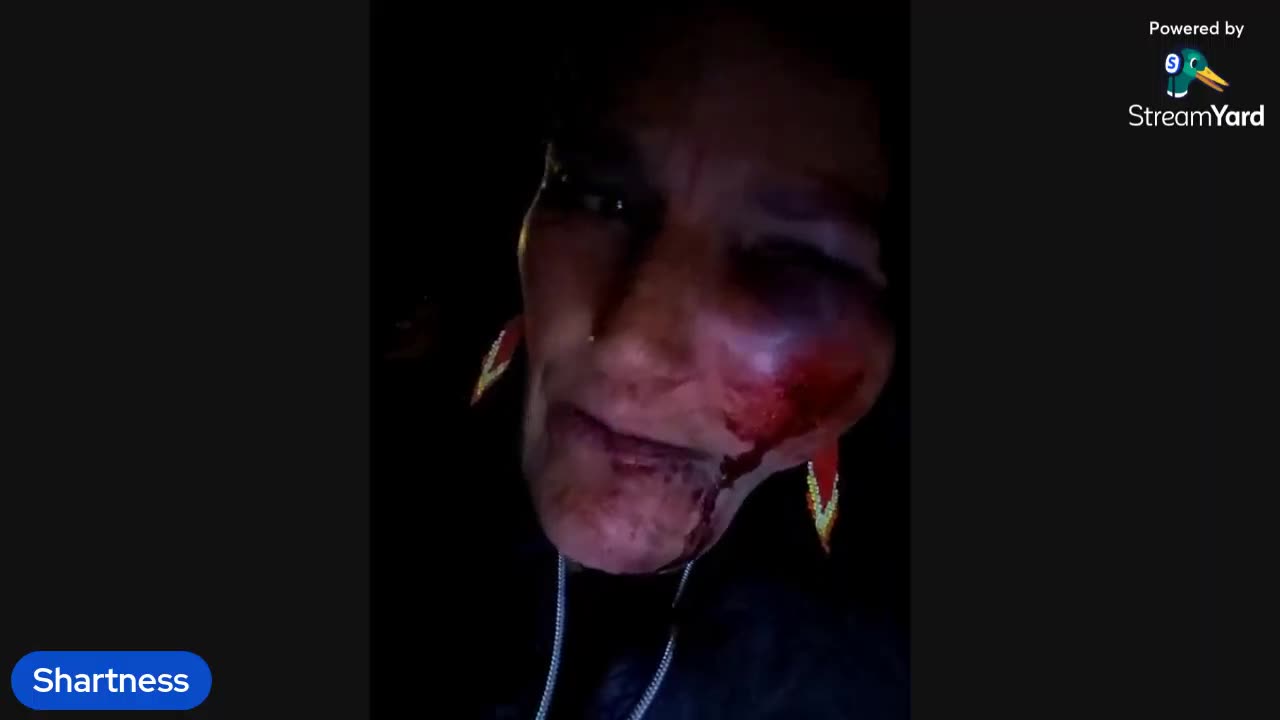 Honeyholic Crashes Her Ebike Aftermath