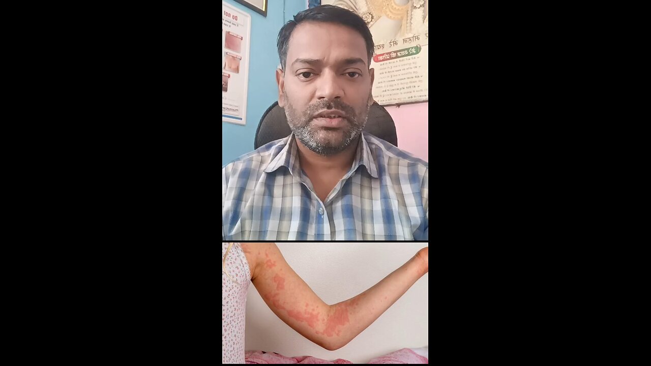 घमौरियों का इलाज ।