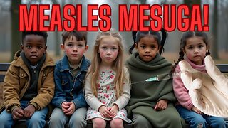 Unbelievable Report! Measles Mesuga!