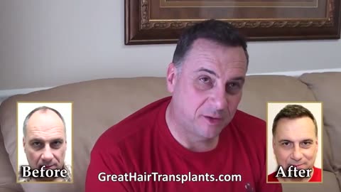 Top Hair Transplant and Restoration Techniques in Petaluma, California - promo